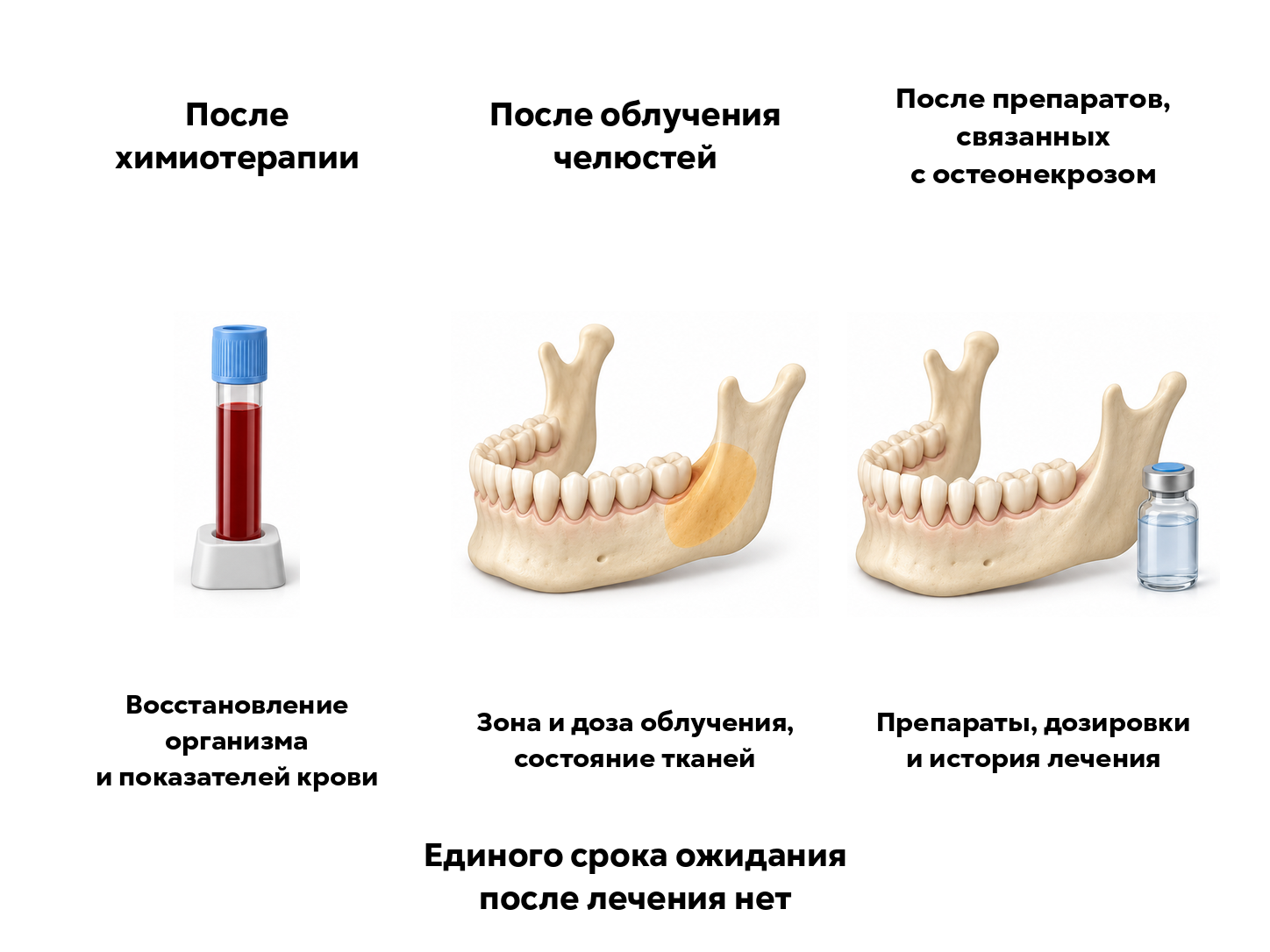 Что оценивают перед имплантацией после химиотерапии, облучения челюсти и лекарственного лечения
